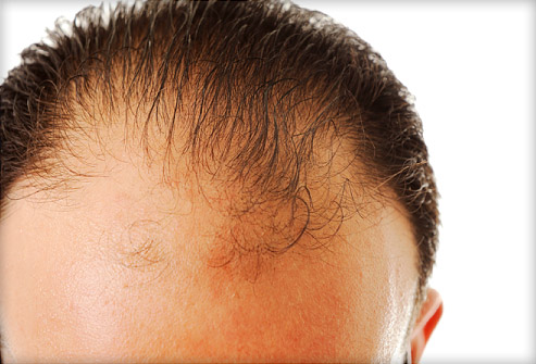 can hair regrow on a scar